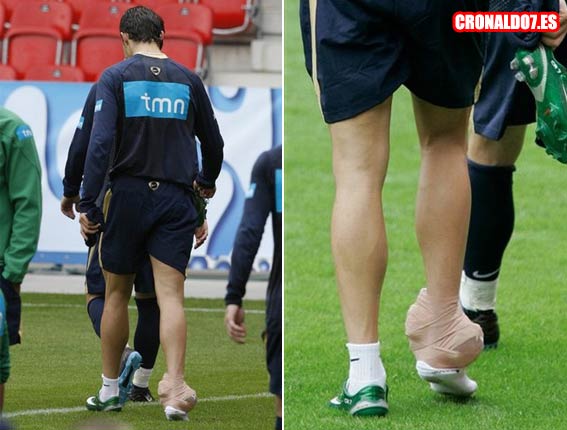 Cristiano Ronaldo lesionado de su tobillo
